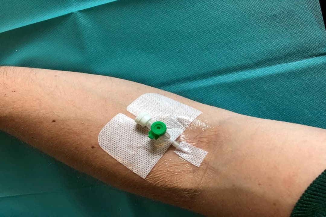 Jak zrobic kolczyk wenflonem bez ryzyka infekcji i bólu